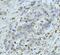 Nucleoporin 210 antibody, A05308, Boster Biological Technology, Immunohistochemistry paraffin image 