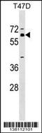 Zinc Finger Protein 554 antibody, 59-537, ProSci, Western Blot image 