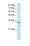 Ribonuclease H2 subunit A antibody, NBP1-58235, Novus Biologicals, Western Blot image 