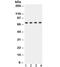 ATP Binding Cassette Subfamily G Member 2 (Junior Blood Group) antibody, R32353, NSJ Bioreagents, Western Blot image 