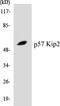 Cyclin Dependent Kinase Inhibitor 1C antibody, EKC1428, Boster Biological Technology, Western Blot image 