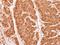 Proteasome Subunit Alpha 2 antibody, LS-C185550, Lifespan Biosciences, Immunohistochemistry paraffin image 