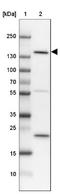 SLIT-ROBO Rho GTPase Activating Protein 3 antibody, NBP1-88831, Novus Biologicals, Western Blot image 