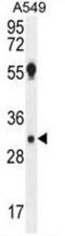 Aquaporin 12B antibody, AP50220PU-N, Origene, Western Blot image 