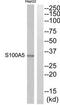 Protein S100-A5 antibody, TA314506, Origene, Western Blot image 