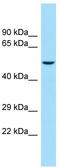 Potassium Voltage-Gated Channel Subfamily J Member 16 antibody, TA338587, Origene, Western Blot image 
