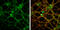 Glutamate Ionotropic Receptor NMDA Type Subunit 2B antibody, GTX133099, GeneTex, Immunofluorescence image 