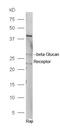 C-C Motif Chemokine Ligand 27 antibody, orb13295, Biorbyt, Western Blot image 
