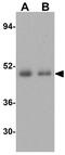 Caspase 5 antibody, GTX31700, GeneTex, Western Blot image 
