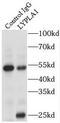 Lysophospholipase 1 antibody, FNab04905, FineTest, Immunoprecipitation image 
