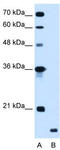 Ring Finger Protein 175 antibody, TA330527, Origene, Western Blot image 