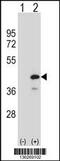 Protein Tyrosine Phosphatase Non-Receptor Type 18 antibody, 58-809, ProSci, Western Blot image 