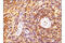 BAX antibody, 14796S, Cell Signaling Technology, Immunohistochemistry paraffin image 