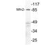 Mitofusin 2 antibody, AP20775PU-N, Origene, Western Blot image 