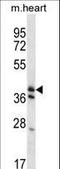 Kruppel Like Factor 2 antibody, LS-C165556, Lifespan Biosciences, Western Blot image 