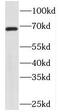 PIF1 5'-To-3' DNA Helicase antibody, FNab06436, FineTest, Western Blot image 