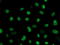 Fragile X mental retardation 1 protein antibody, LS-C173787, Lifespan Biosciences, Immunofluorescence image 