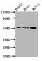 CDP-Diacylglycerol Synthase 2 antibody, CSB-PA005123LA01HU, Cusabio, Western Blot image 