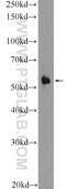 Carnosine Dipeptidase 1 antibody, 17759-1-AP, Proteintech Group, Western Blot image 