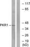 Prokineticin Receptor 1 antibody, TA315119, Origene, Western Blot image 