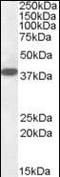 Laforin antibody, orb95330, Biorbyt, Western Blot image 