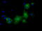 Pyruvate Kinase L/R antibody, M02282, Boster Biological Technology, Immunofluorescence image 