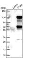 Adaptor Related Protein Complex 3 Subunit Beta 2 antibody, NBP1-81011, Novus Biologicals, Western Blot image 