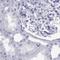 Stromal Antigen 3 antibody, NBP2-47258, Novus Biologicals, Immunohistochemistry paraffin image 