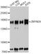 Zinc Finger MYND-Type Containing 8 antibody, A8737, ABclonal Technology, Western Blot image 