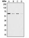 Akt antibody, LS-C351801, Lifespan Biosciences, Western Blot image 
