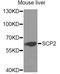 Sterol Carrier Protein 2 antibody, A5382, ABclonal Technology, Western Blot image 