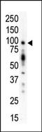 Protein Kinase D1 antibody, AP13552PU-N, Origene, Western Blot image 
