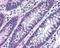Metastasis suppressor protein 1 antibody, PA5-23197, Invitrogen Antibodies, Immunohistochemistry paraffin image 