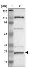 Germinal Center Associated Signaling And Motility antibody, PA5-51712, Invitrogen Antibodies, Western Blot image 