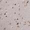 MLLT1 Super Elongation Complex Subunit antibody, HPA031166, Atlas Antibodies, Immunohistochemistry frozen image 