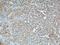 Wnt Family Member 5A antibody, 55184-1-AP, Proteintech Group, Immunohistochemistry paraffin image 