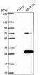 Defensin Beta 125 antibody, PA5-60235, Invitrogen Antibodies, Western Blot image 