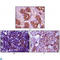 BLK Proto-Oncogene, Src Family Tyrosine Kinase antibody, LS-C812403, Lifespan Biosciences, Immunohistochemistry paraffin image 