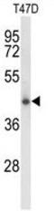 Ceroid-lipofuscinosis neuronal protein 5 antibody, GTX80945, GeneTex, Western Blot image 
