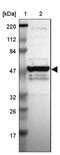 Zinc Finger Protein 764 antibody, NBP1-92115, Novus Biologicals, Western Blot image 