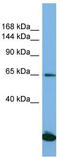 Splicing Factor 3b Subunit 3 antibody, TA335890, Origene, Western Blot image 