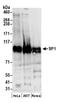 Sp1 Transcription Factor antibody, A300-134A, Bethyl Labs, Western Blot image 