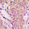 ShcA antibody, LS-C358320, Lifespan Biosciences, Immunohistochemistry paraffin image 