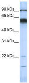 Matrix Metallopeptidase 16 antibody, TA339029, Origene, Western Blot image 