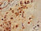 C-Type Lectin Domain Containing 7A antibody, orb52162, Biorbyt, Immunohistochemistry paraffin image 