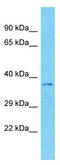 E3 ubiquitin-protein ligase MARCH5 antibody, TA329866, Origene, Western Blot image 
