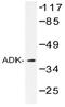 Adenosine Kinase antibody, AP20391PU-N, Origene, Western Blot image 