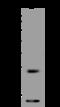 Stefin-B antibody, 200660-T44, Sino Biological, Western Blot image 