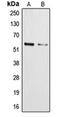Cytochrome P450 Family 3 Subfamily A Member 4 antibody, orb213829, Biorbyt, Western Blot image 