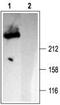 Inositol 1,4,5-Trisphosphate Receptor Type 1 antibody, TA328735, Origene, Western Blot image 